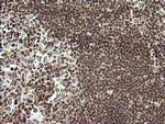 RTKN Antibody in Immunohistochemistry (Paraffin) (IHC (P))