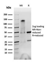 Integrin alpha V + beta 6 Antibody in SDS-PAGE (SDS-PAGE)