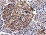 RTN4IP1 Antibody in Immunohistochemistry (Paraffin) (IHC (P))