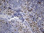 RUNX3 Antibody in Immunohistochemistry (Paraffin) (IHC (P))