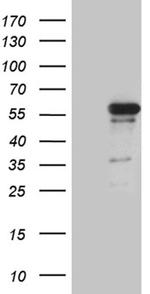 RUNX3 Antibody in Western Blot (WB)