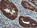 RUVBL2 Antibody in Immunohistochemistry (Paraffin) (IHC (P))