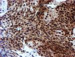 RUVBL2 Antibody in Immunohistochemistry (Paraffin) (IHC (P))