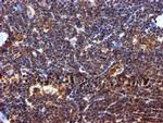 RUVBL2 Antibody in Immunohistochemistry (Paraffin) (IHC (P))