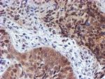 RUVBL2 Antibody in Immunohistochemistry (Paraffin) (IHC (P))