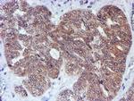 RUVBL2 Antibody in Immunohistochemistry (Paraffin) (IHC (P))