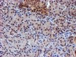 RUVBL2 Antibody in Immunohistochemistry (Paraffin) (IHC (P))