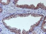 RUVBL2 Antibody in Immunohistochemistry (Paraffin) (IHC (P))