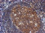 RUVBL2 Antibody in Immunohistochemistry (Paraffin) (IHC (P))