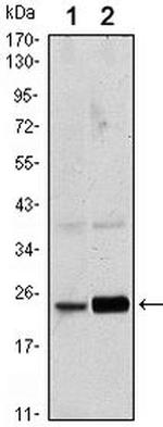 RAB10 Antibody in Western Blot (WB)