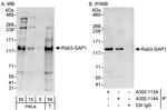 Rab3-GAP1 Antibody in Western Blot (WB)