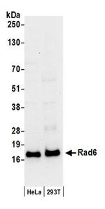 Rad6 Antibody in Western Blot (WB)