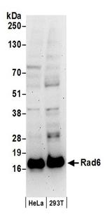 Rad6 Antibody in Western Blot (WB)