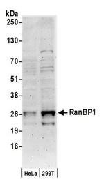 RanBP1 Antibody in Western Blot (WB)