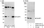 RanBP1 Antibody in Western Blot (WB)