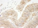 RanBP1 Antibody in Immunohistochemistry (IHC)