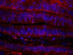 RanBP1 Antibody in Immunohistochemistry (IHC)