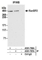 RanBP2 Antibody in Western Blot (WB)