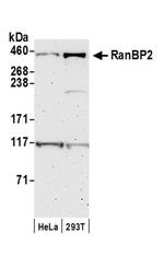 RanBP2 Antibody in Western Blot (WB)