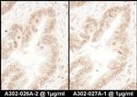 RanGAP1 Antibody in Immunohistochemistry (IHC)