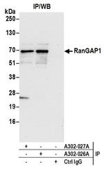 RanGAP1 Antibody in Western Blot (WB)