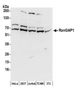 RanGAP1 Antibody in Western Blot (WB)