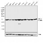 Rat IgG2a Secondary Antibody in Western Blot (WB)