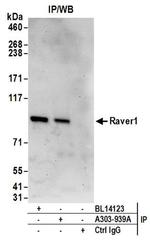 Raver1 Antibody in Western Blot (WB)