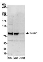 Raver1 Antibody in Western Blot (WB)