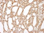 RecQ1 Antibody in Immunohistochemistry (IHC)