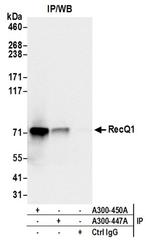 RecQ1 Antibody in Western Blot (WB)