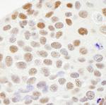 RecQ1 Antibody in Immunohistochemistry (IHC)