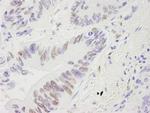 RecQ1 Antibody in Immunohistochemistry (IHC)