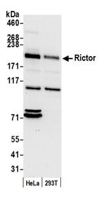 Rictor Antibody in Western Blot (WB)