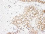 Rictor Antibody in Immunohistochemistry (IHC)