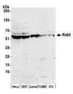 Ro60 Antibody in Western Blot (WB)