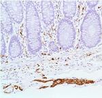 S100B Antibody in Immunohistochemistry (Paraffin) (IHC (P))