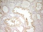 S100A1 Antibody in Immunohistochemistry (Paraffin) (IHC (P))