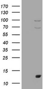 S100A1 Antibody in Western Blot (WB)