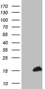 S100A1 Antibody in Western Blot (WB)