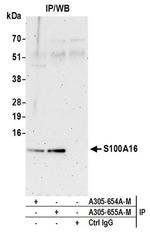 S100A16 Antibody in Immunoprecipitation (IP)