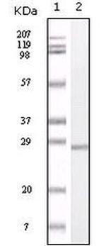 S100A1 Antibody in Western Blot (WB)