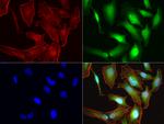 S100A9 Antibody in Immunocytochemistry (ICC/IF)