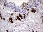 S100A9 Antibody in Immunohistochemistry (Paraffin) (IHC (P))