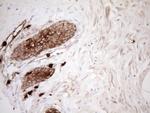 S100A9 Antibody in Immunohistochemistry (Paraffin) (IHC (P))