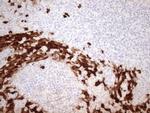 S100A9 Antibody in Immunohistochemistry (Paraffin) (IHC (P))