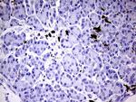 S100A9 Antibody in Immunohistochemistry (Paraffin) (IHC (P))