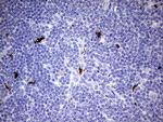 S100A9 Antibody in Immunohistochemistry (Paraffin) (IHC (P))