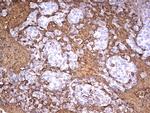 S100A9 Antibody in Immunohistochemistry (Paraffin) (IHC (P))