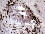 S100A9 Antibody in Immunohistochemistry (Paraffin) (IHC (P))